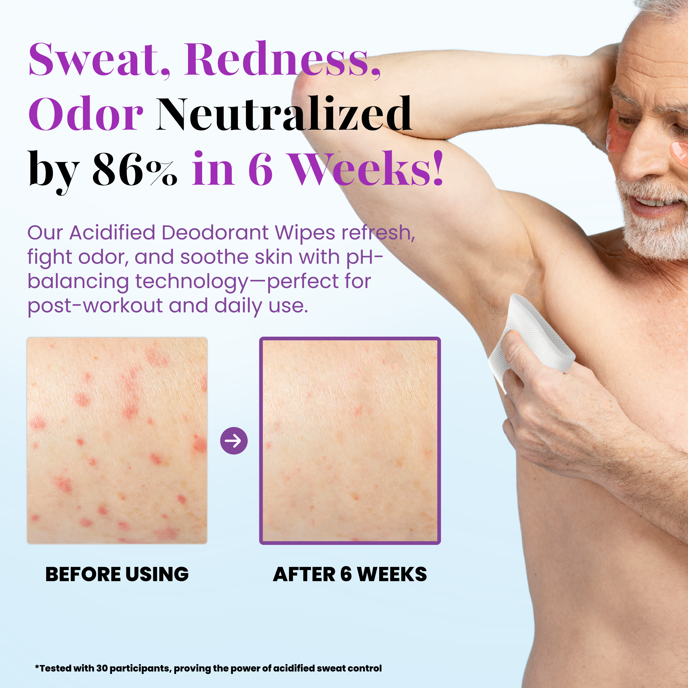 A man uses Bare Fresh Deodorant Wipes by Zero Trace on his underarm, demonstrating a visible reduction in redness and irritation. Before-and-after images illustrate an 86% improvement after six weeks of use.