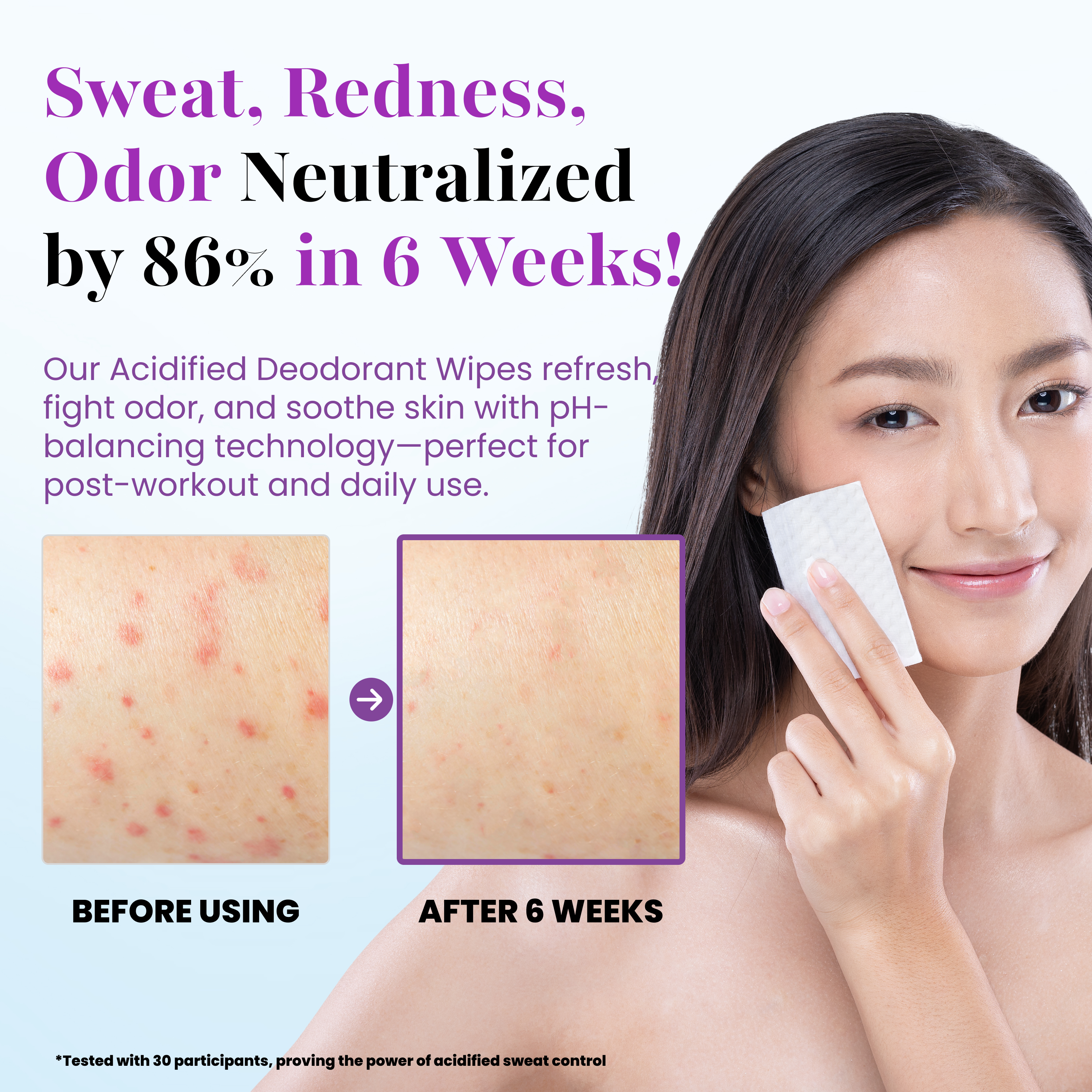 A woman displays Fresh Botanic Deodorant Wipes by Zero Trace, with before and after skin photos highlighting their effectiveness. Text notes 86% improvement in six weeks, stressing these aluminum-free, pH-balanced wipes' multi-use benefits.